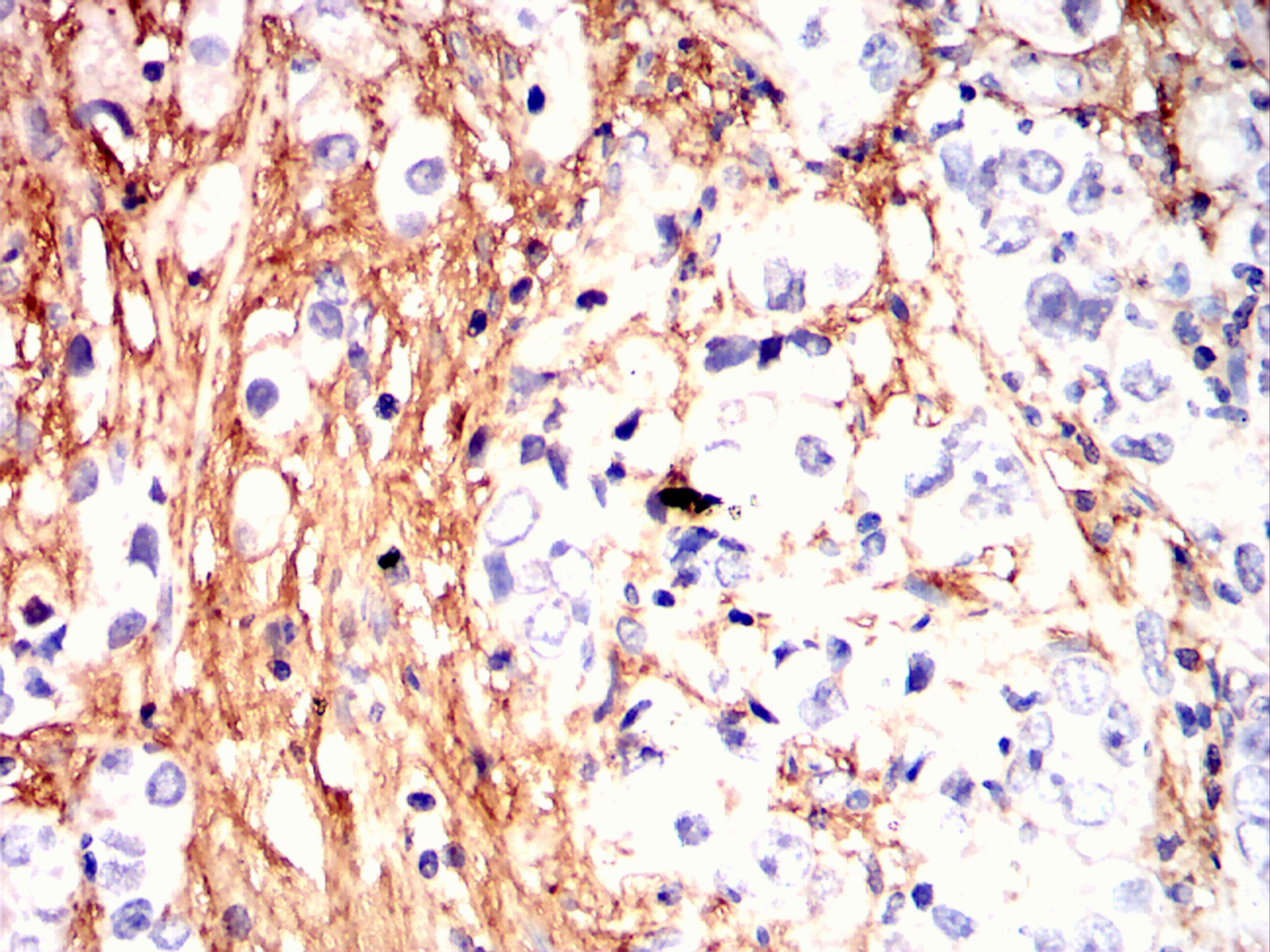 		IHC